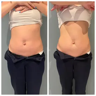 【大名】 NicoLのエステ・リラクイメージ