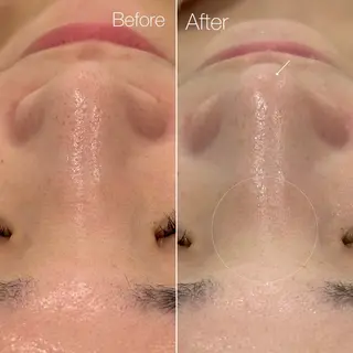 〈etre〉トータルビューティーサロン所属・etre - 韓国肌管理 -のエステ・リラクイメージ