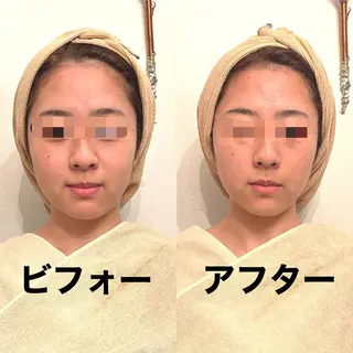 おうちサロン B-ROOMのエステ・リラクイメージ