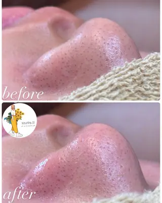 sourire.11 ‪☺︎‬‪emiのエステ・リラクイメージ