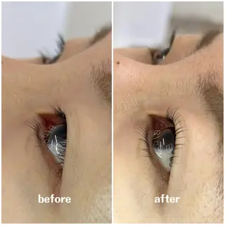 マツエク・マツパ Rukka Eye&Beautysalon所属・Rukka TOMOMIのエステ・リラクイメージ