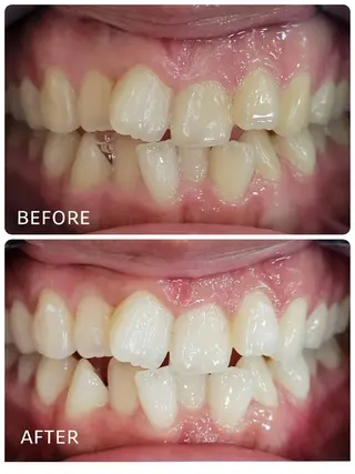 ホワイトニングサロン ラウレアのその他イメージ