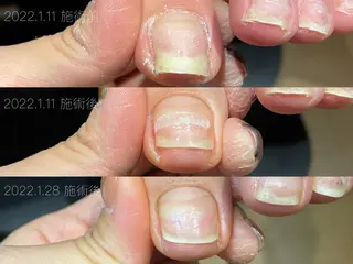 ネイル cachette mのネイルデザイン