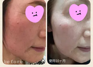 yukari ☺︎のネイルデザイン