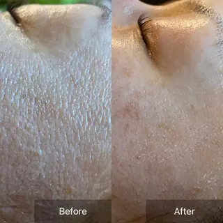 Mandarin Orange所属・毛穴から始める肌メン テマンダリンオレンジのエステ・リラクイメージ