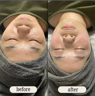 ele"ハーブ ピーリング 専門店のエステ・リラクイメージ