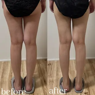 Rutio所属・Rutio 筋膜リリースのエステ・リラクイメージ