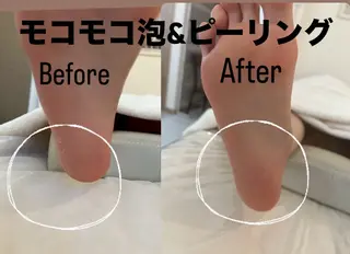 IRISE エステのエステ・リラクイメージ