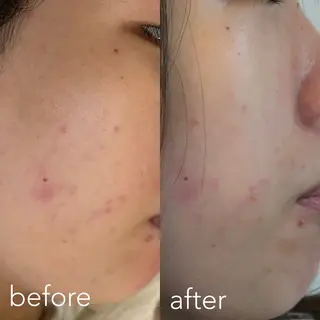 エステティックサロン Liente(リアンテ)所属・Hashimoto .のエステ・リラクイメージ