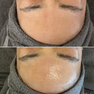 Blue Moon 【ブルームーン】のエステ・リラクイメージ