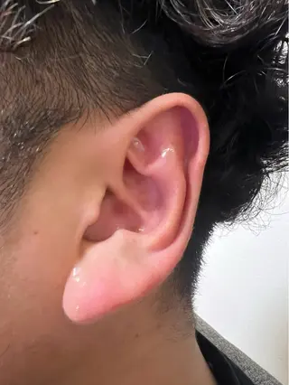 Jewelit所属・耳つぼジュエリー Jewelitのその他イメージ