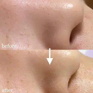 毛穴専門サロン　フルール所属・フルールFululu 自由が丘のエステ・リラクイメージ