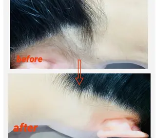 脱毛フェイシャル痩身 エリア最安👑永野舞のエステ・リラクイメージ