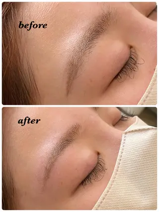 アイブロウ ハーブピーリング/韓国肌管理/フェイシャル/毛穴洗浄/眉毛/顔脱毛【糸脱毛専門】rev所属・ハーブピーリング🌹 毛穴洗浄❤️眉waxのエステ・リラクイメージ