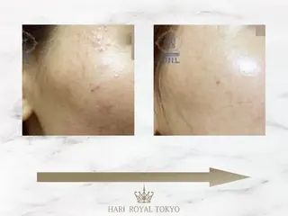 ハリロイヤルトーキョー武蔵小山所属・ニューハーフ鍼灸師 🖤🤍Saya🌹のエステ・リラクイメージ