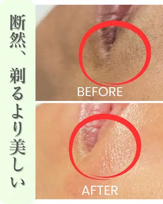 フェイシャルワックス GLOW所属・渡邊 真依のエステ・リラクイメージ