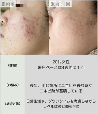 脱毛・眉毛・フェイス サロンN久留米店の眉毛・アイブロウイメージ