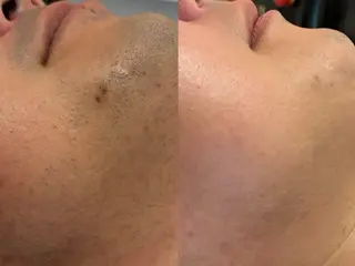 Monart -deux-のエステ・リラクイメージ