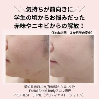 PRETTIEST SHINE所属・山田 浩子のエステ・リラクイメージ