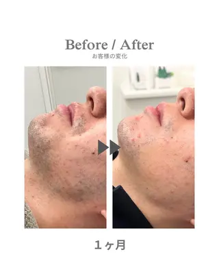 メンズ エステサロンNarcis〜ナルシス〜所属・脱毛＆痩身エステ Narcisのエステ・リラクイメージ