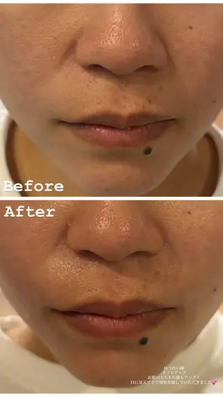 デ・アイム　西船橋所属・吉永玲奈 ニキビ/毛穴/シミのエステ・リラクイメージ