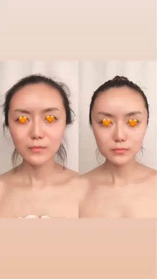 angeailes 小顔矯正サロンのエステ・リラクイメージ