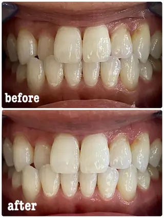 ホワイトニングサロン ラウレアのその他イメージ