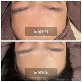 産毛専門店 Bittoのエステ・リラクイメージ