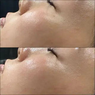 LiZA エステティックサロンのエステ・リラクイメージ