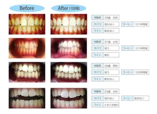 セルフホワイトニング 松原のエステ・リラクイメージ