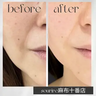 sourire麻布十番店所属・sourire スリールのエステ・リラクイメージ