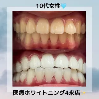 Kaula所属・Kaula ホワイトニング耳ツボのその他イメージ