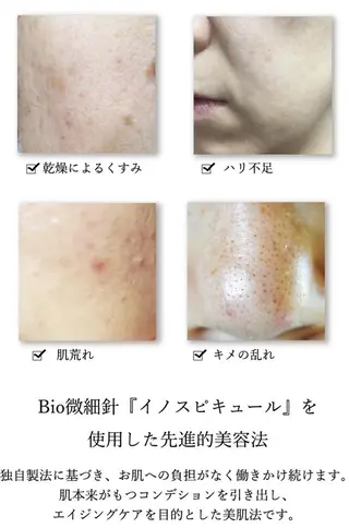 EYE LASH LAPISのエステ・リラクイメージ