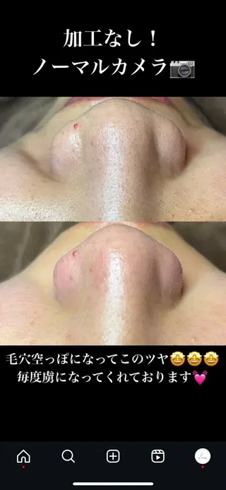 セルフエステエンリケ明石大久保店所属・夕希 毛穴と脱毛特化サロンのエステ・リラクイメージ