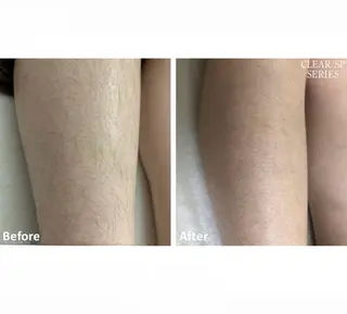 脱毛サロン　ニカ所属・☀️脱毛・美容矯正 サロン　ニカ☀️のエステ・リラクイメージ