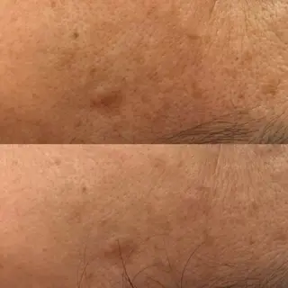 べアール所属・小顔/毛穴/ニキビ salon bealのエステ・リラクイメージ