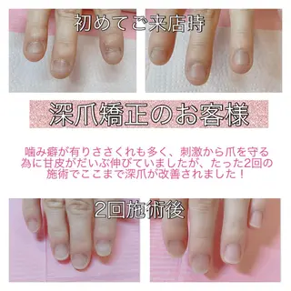 ネイル 吉田 佳代子のネイルデザイン