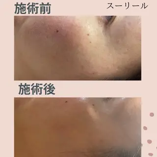 肌荒れに悩む方のため オイルフリーサロンのマツエク・マツパデザイン