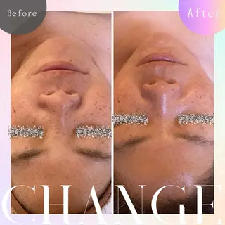 プライベートサロン 座間市/LOKAHIのエステ・リラクイメージ