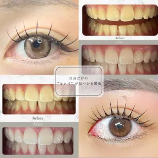 マツエク・マツパ Soibeauty所属・Nana °のエステ・リラクイメージ