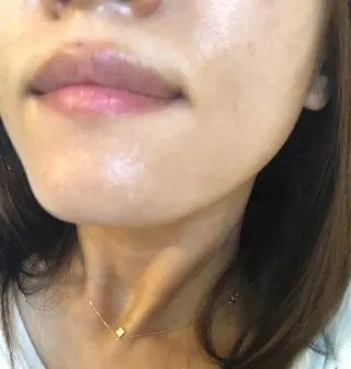 Momo Eggs所属・Momo Eggsのエステ・リラクイメージ