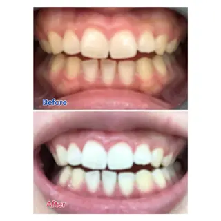 MBEAUTYSALON 千葉店・京成大久保所属・Melty 輝のその他イメージ