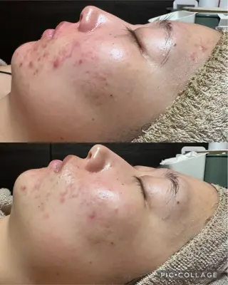 エステ✖️ネイル Feelのネイルデザイン