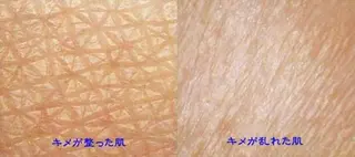 メンズ MOARoom所属・毛利 明代のエステ・リラクイメージ