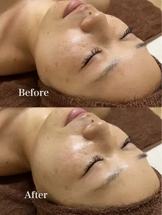 Daisy ~Beauty care by DANA~所属・ハーブピーリング🌿 danaのエステ・リラクイメージ