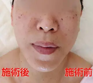 MAXまつ毛&  フェイシャルのマツエク・マツパデザイン