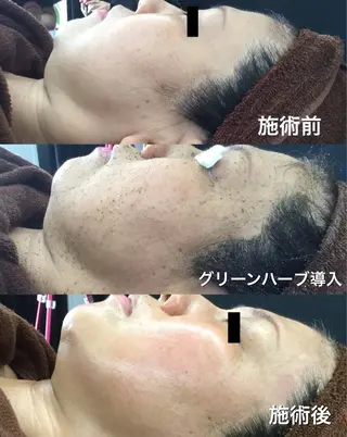 オールハンド フェイシャルのエステ・リラクイメージ