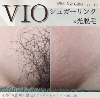 emirai🌱 AYUMIのエステ・リラクイメージ