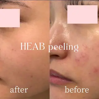 美肌salon GRAN CUORE所属・Natsuki🌙 GRAN CUOREのエステ・リラクイメージ