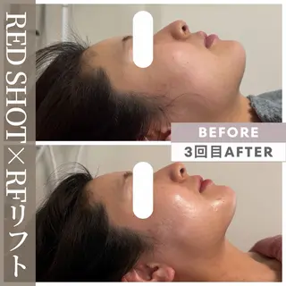 小顔矯正専門店 【RED】池田のエステ・リラクイメージ